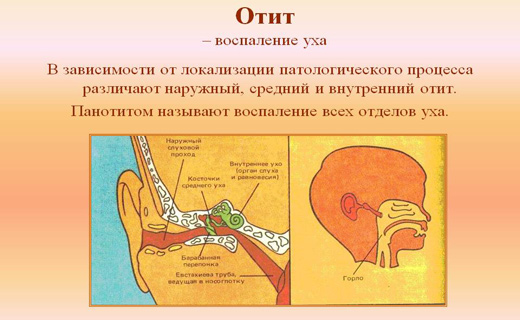 отит