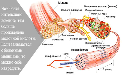 причины болей в мышцах
