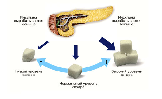 дисбаланс инсулина