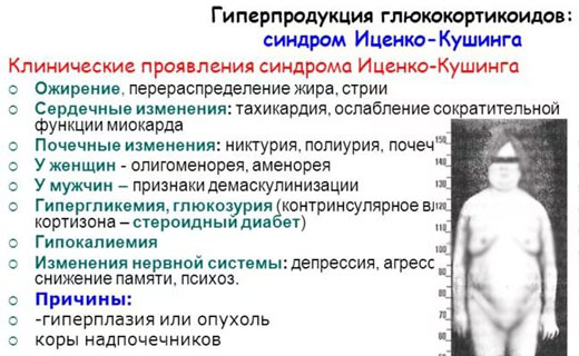 болезнь Аддисона