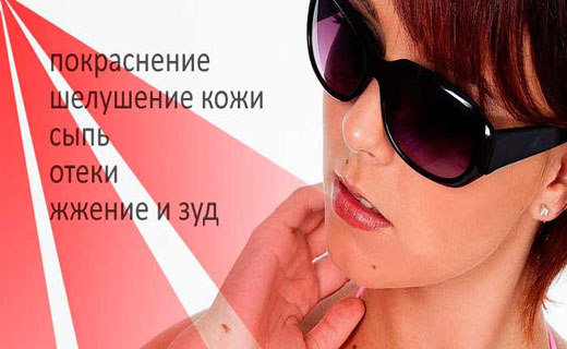аллергия на солнце