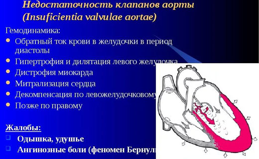 недостаточность
