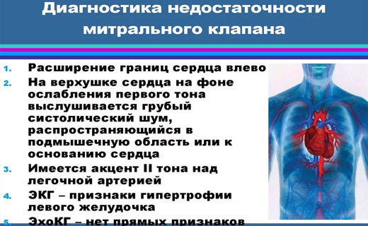 недостаточность