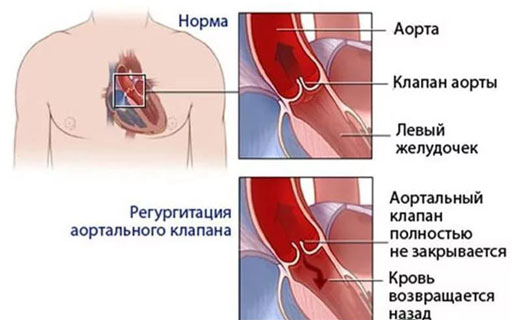 недостаточность