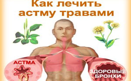 Лечим астму в домашних условиях Лечим астму в домашних условиях
