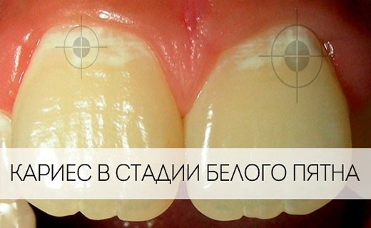 пенсия