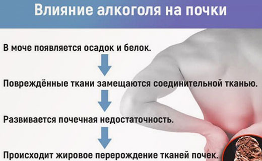почки