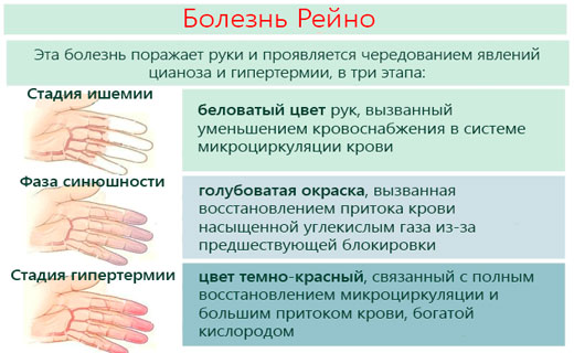 болезнь сердца