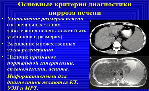 печень