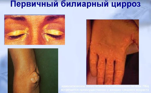 печень