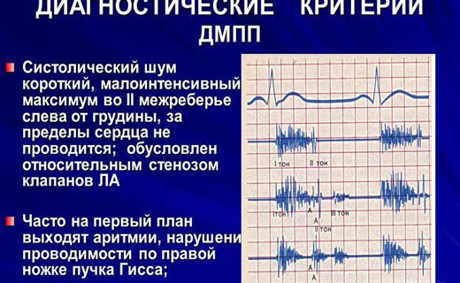 болезнь сердца