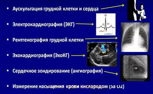 болезнь сердца
