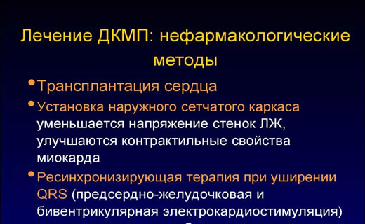 кардиомиопатия