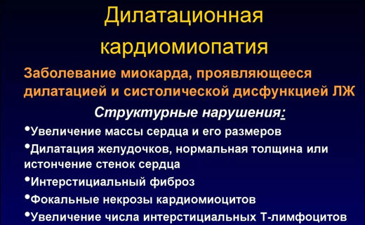 кардиомиопатия