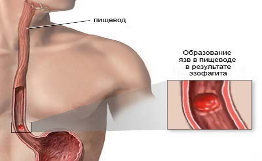 химическое лечение паразитов химическое лечение паразитов