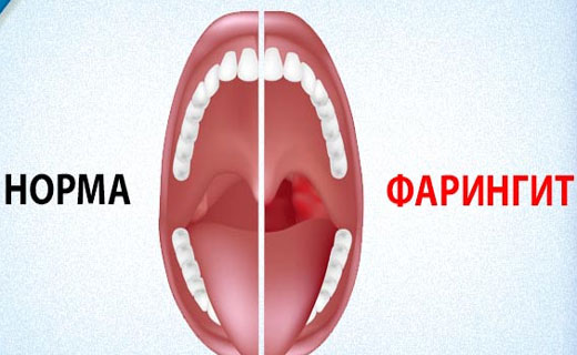 кашель