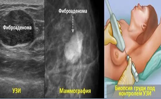 молочные железы