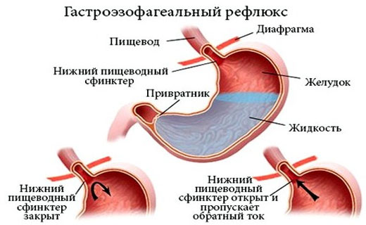 рефдюкс