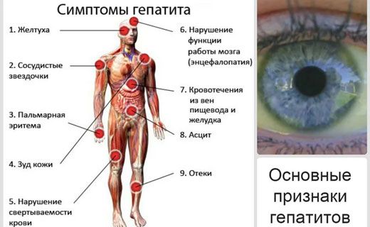 желтуха