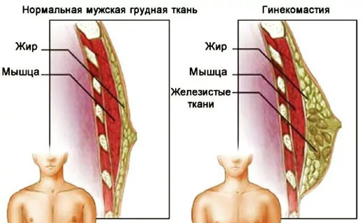 молочные железы