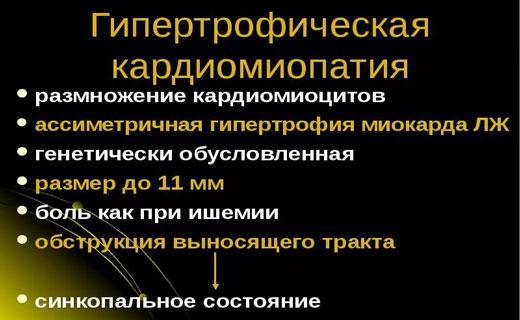 кардиомиопатия