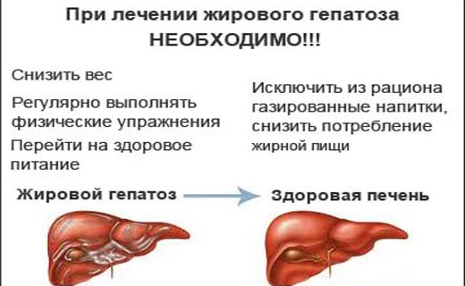 Жирная Печень Симптомы Лечение Диета