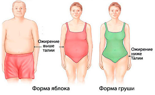 как бороться с ожирением