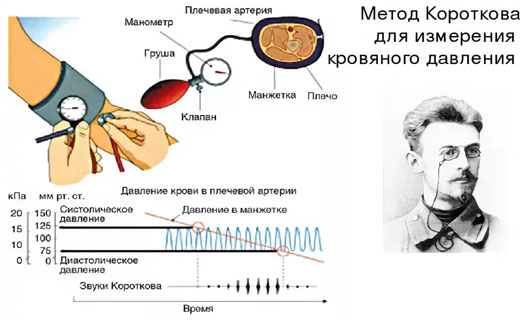 болезни сердца