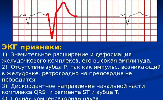 болезнь сердца