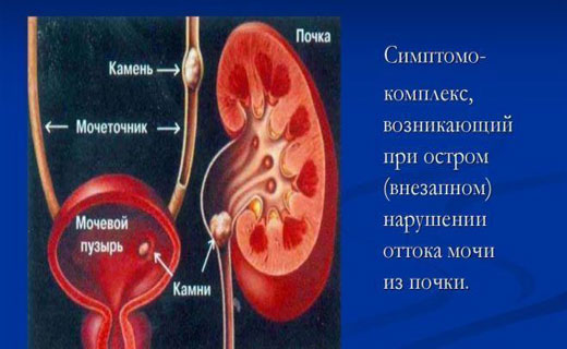почки