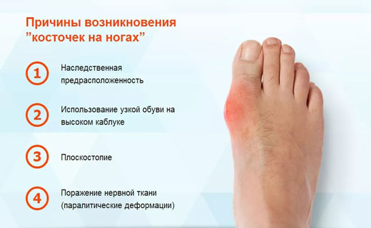 контрактура сустава