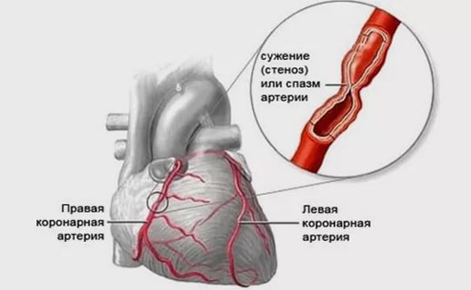 гловной мозг