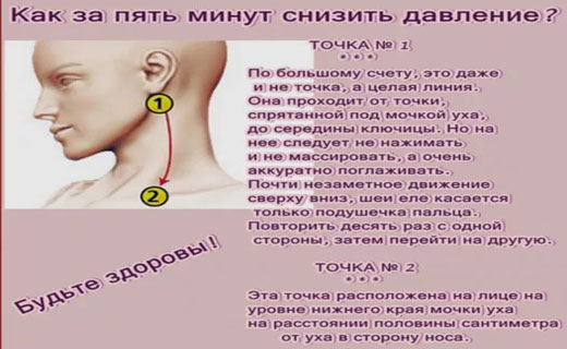 аритмия сердца