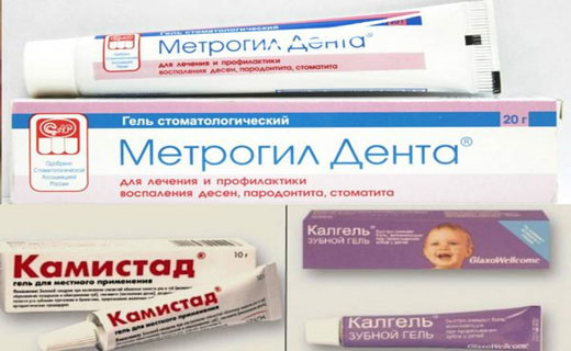 лечение стоматита