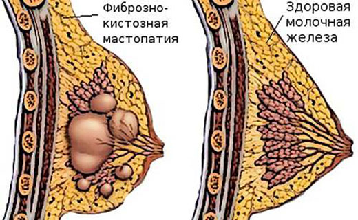 молочные железы