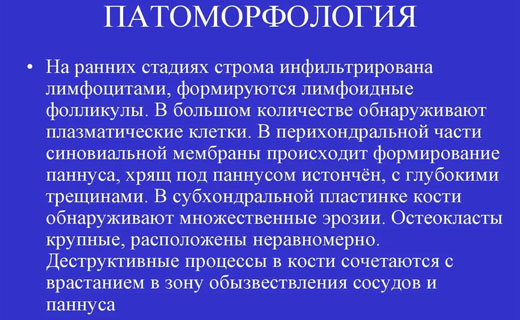 полиартрит
