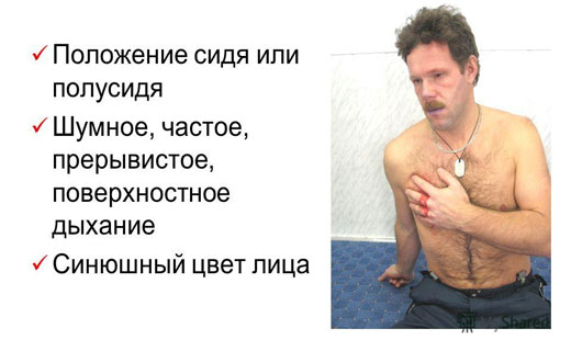 дыхательная недостаточность