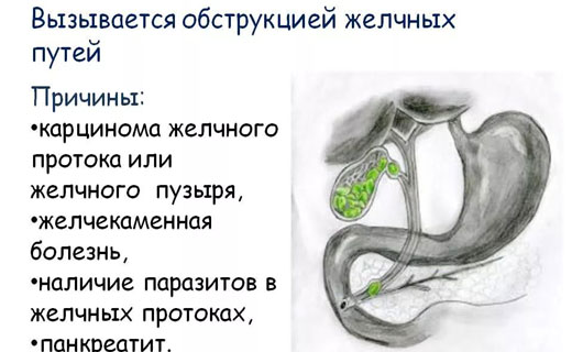 желтуха