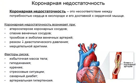 недостаточность