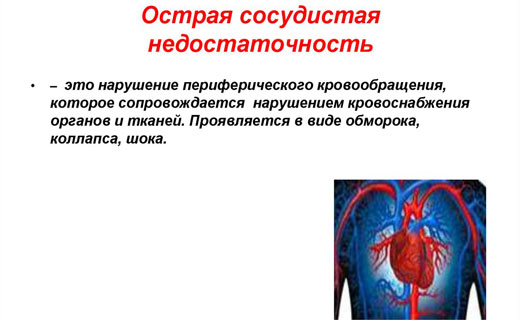 сосудистая недостаточность