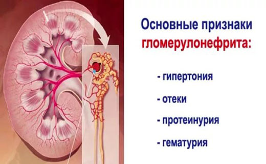 почки