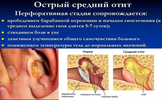защита организма