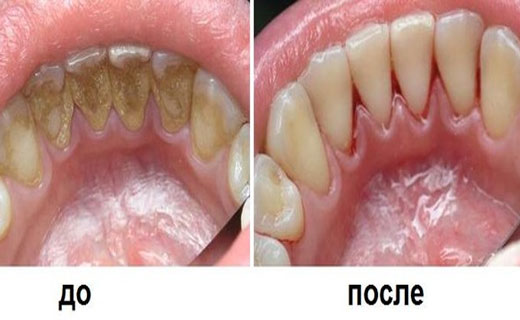 пенсия