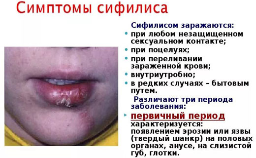 cbabkbc