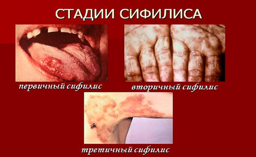 cbabkbc