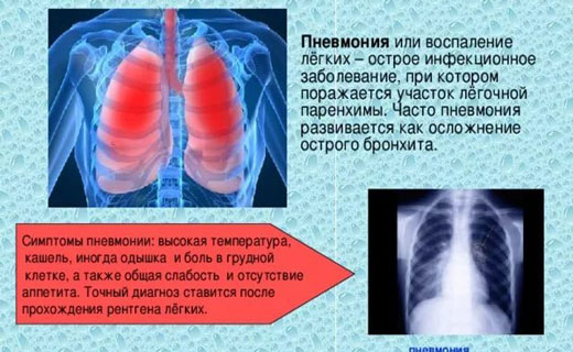 пневмания