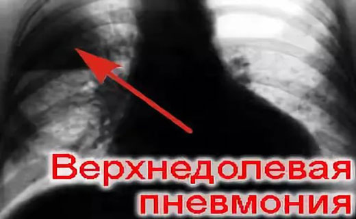 пневмания