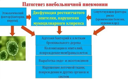 пневмания