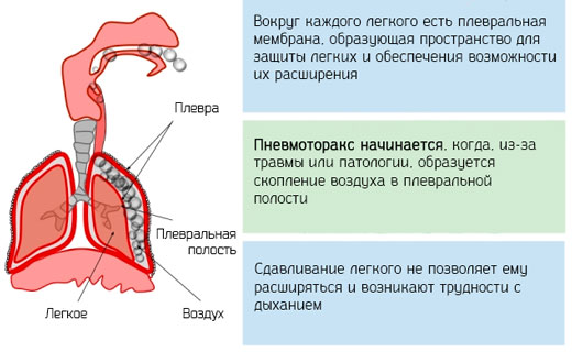 инфекции
