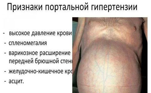 печень